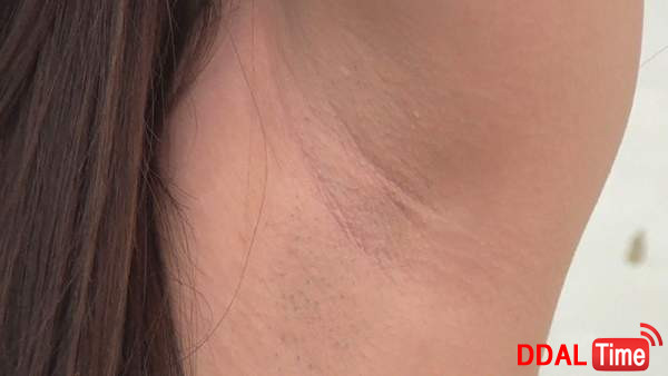 KAGP-176 이미지 #16