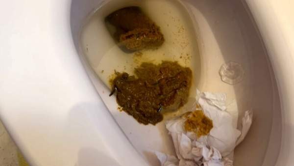 KBMS-194 이미지 #13