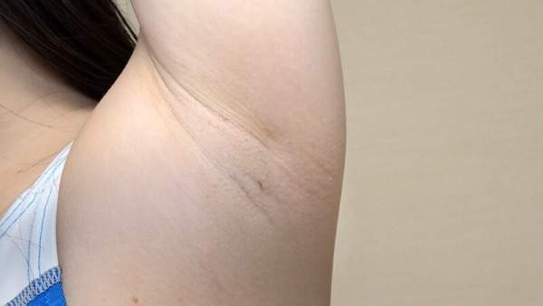 ANG-010 이미지 #5