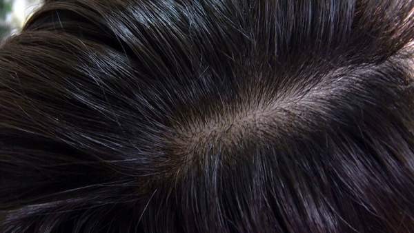 NEO-835 이미지 #18