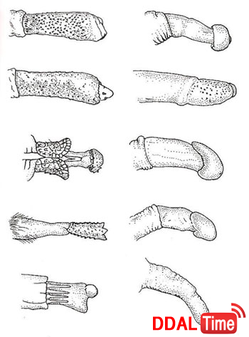 섹스 도중 당황스러운 순간, 슬기롭게 대처하기 이미지 #3