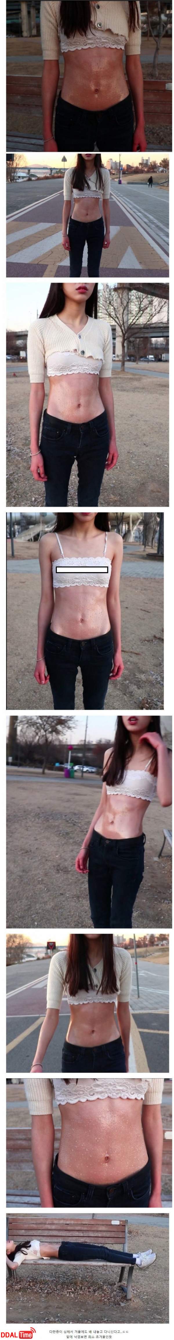 배 쪽에만 다한증이 심한 누나 이미지 #1